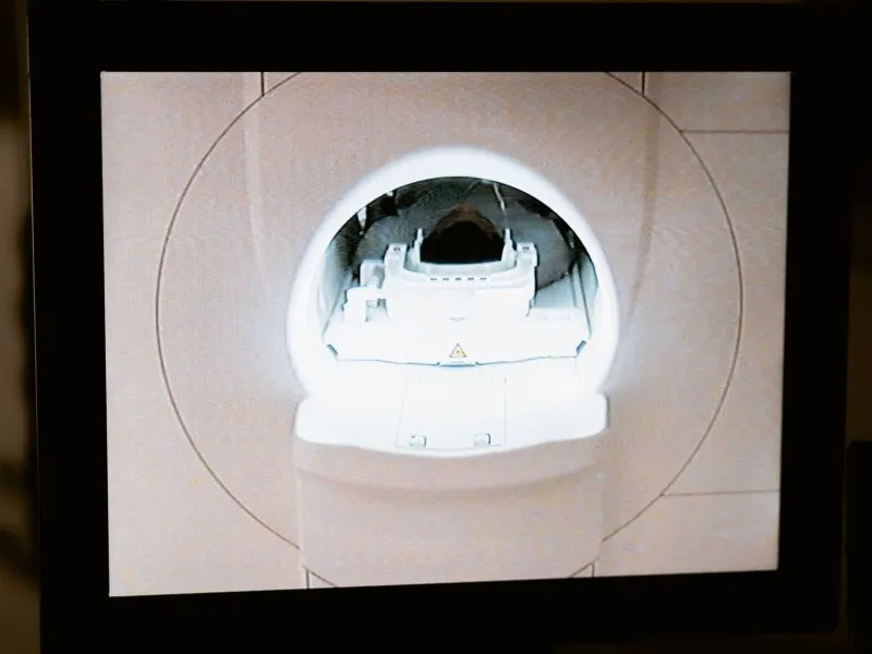 CT Scan