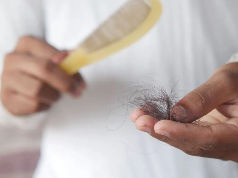 Panduan memilih perawatan klinik rambut rontok: 6 pilihan dan bedanya